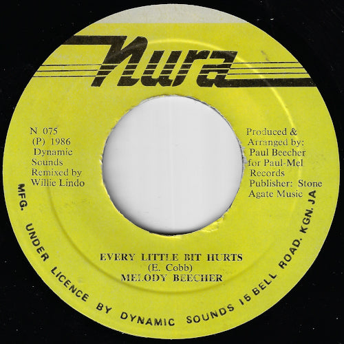 Every Little Bit Hurts / Every Little Dub Hurts
