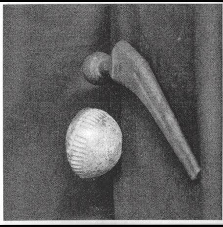 Ball And Socket